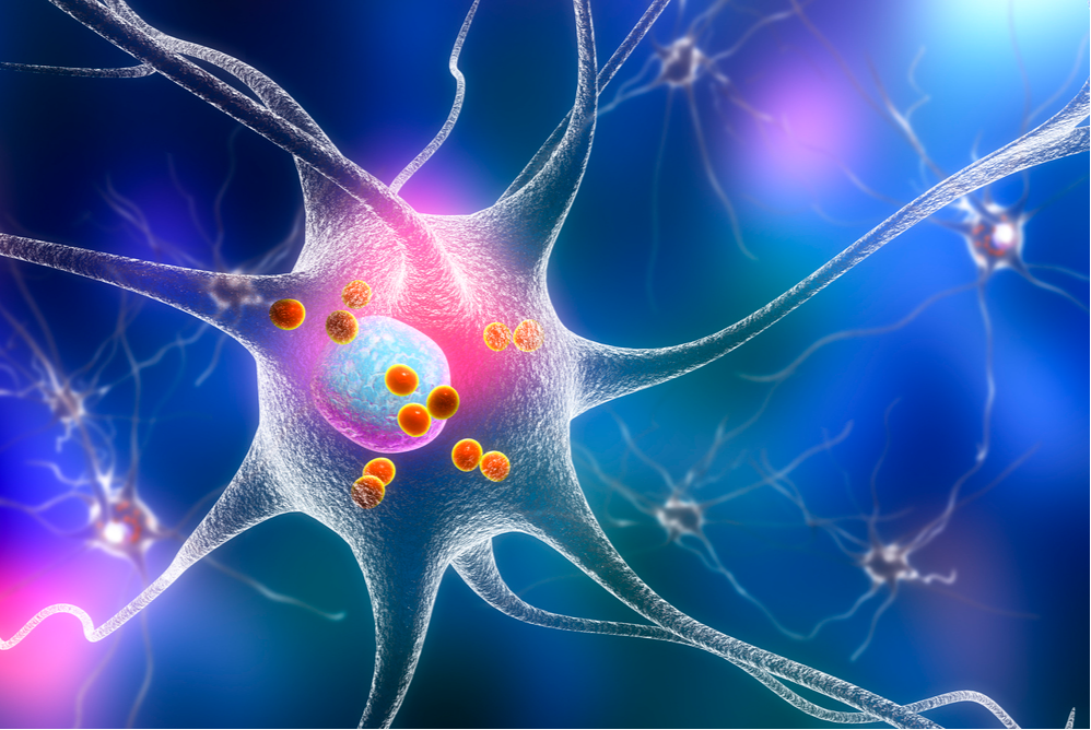 What Is Parkinson’s Disease Dementia, and How Does It Manifest?