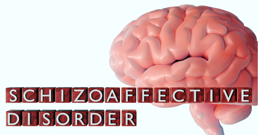 Schizoaffective Disorder, Bipolar Type: What It Is and How It Manifests