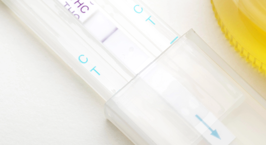 Why Parents Should Drug Test Their Kids for Safety